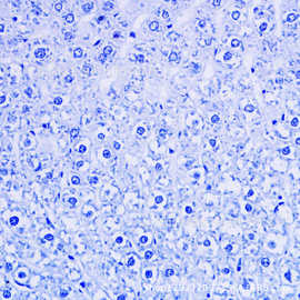 0成交0笔4年复购率:0%巴氏染色液苏木素染液(harris)ea