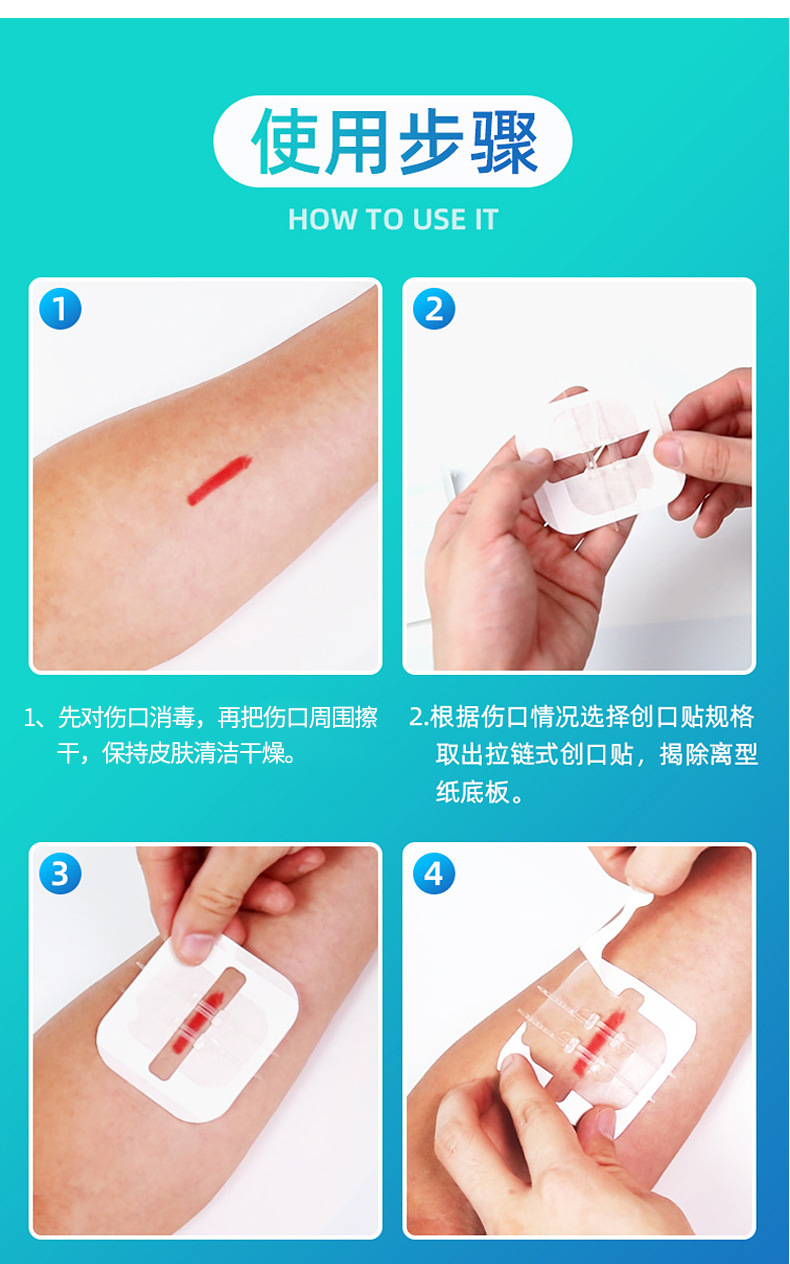 拉链式缝合器减张贴伤口家用免缝合贴皮肤减张器吻合器拉合贴固定