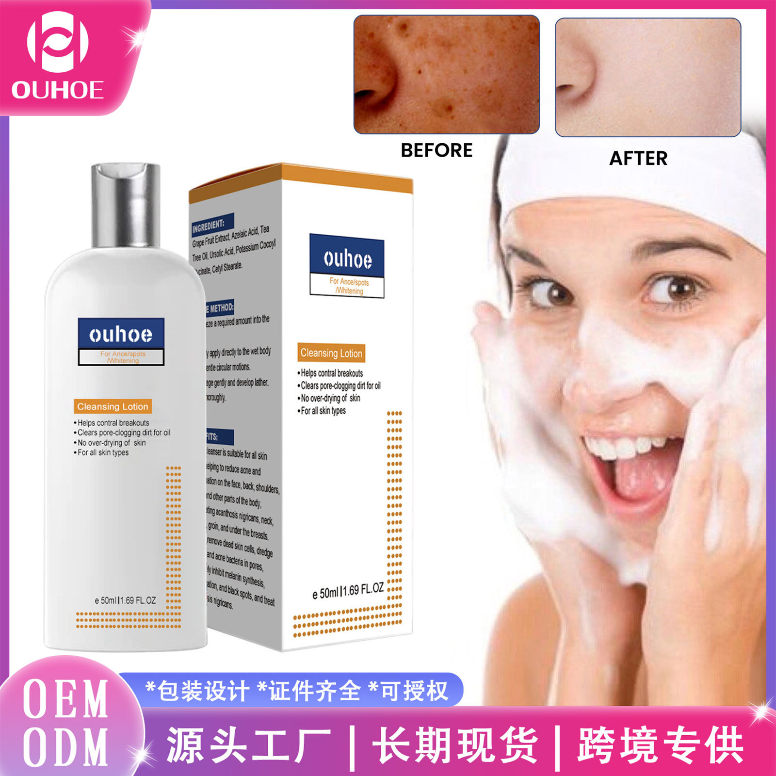 Ouhoe Black Acanthosis Facial Cleanser Deep Cleansing Softening Skin Oil Control Repair Fade Face Dark