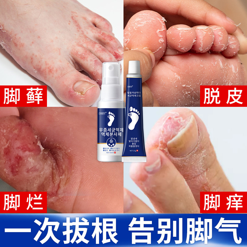 力克宁脚气药喷剂 去脚气脚臭脚痒脱皮烂脚丫汗脚止痒药膏-阿里巴巴