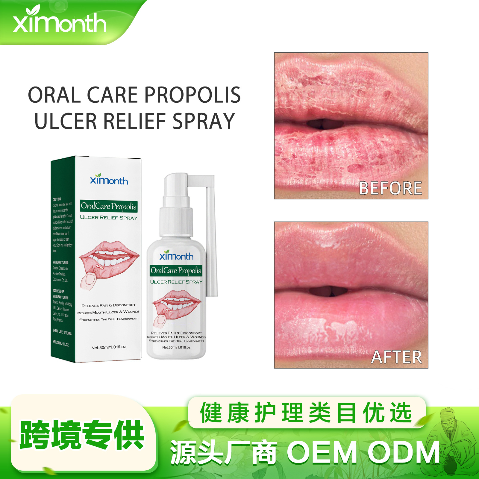 ximonth口腔溃炀缓解喷雾 缓解口腔牙龈肿痛唇部干裂口疮护理喷剂