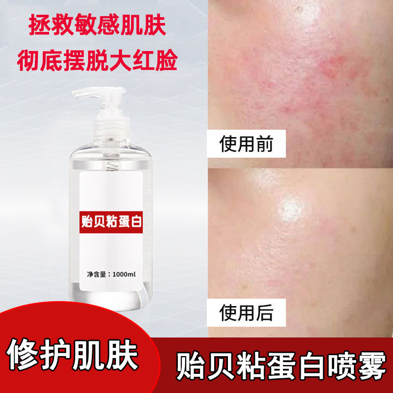贻贝粘蛋白喷雾 淡化红血丝修护角质层敏感肌激素脸止痒修护精华