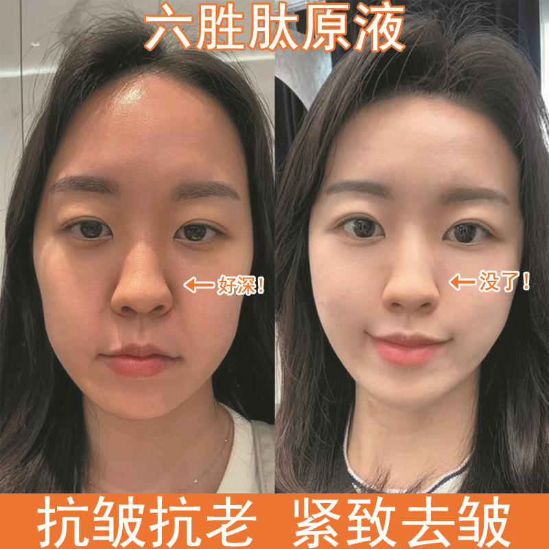 六胜肽抗皱原液祛淡化细纹法令纹提拉紧致液涂抹式面部精华液原液