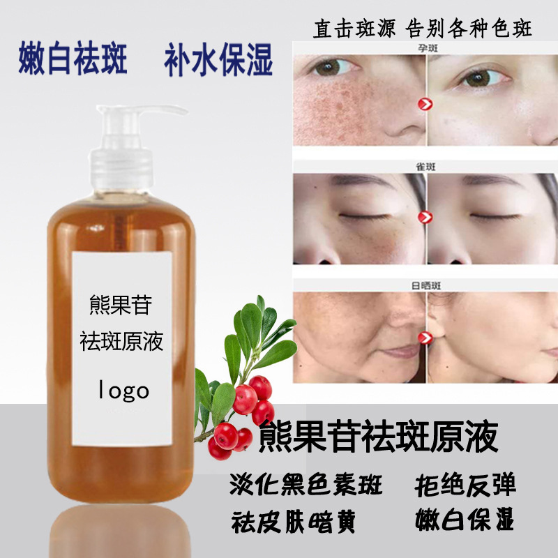 传明酸熊果苷祛斑原液 祛黑色素美白祛斑精华液 光甘草定祛斑精华