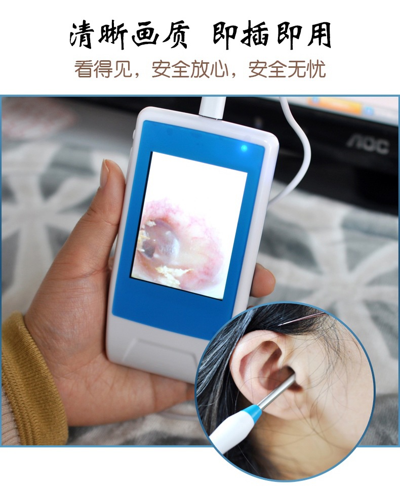 采耳工具套装挖耳勺可视耳镜可看见耳膜耳鼻喉内窥镜检测仪