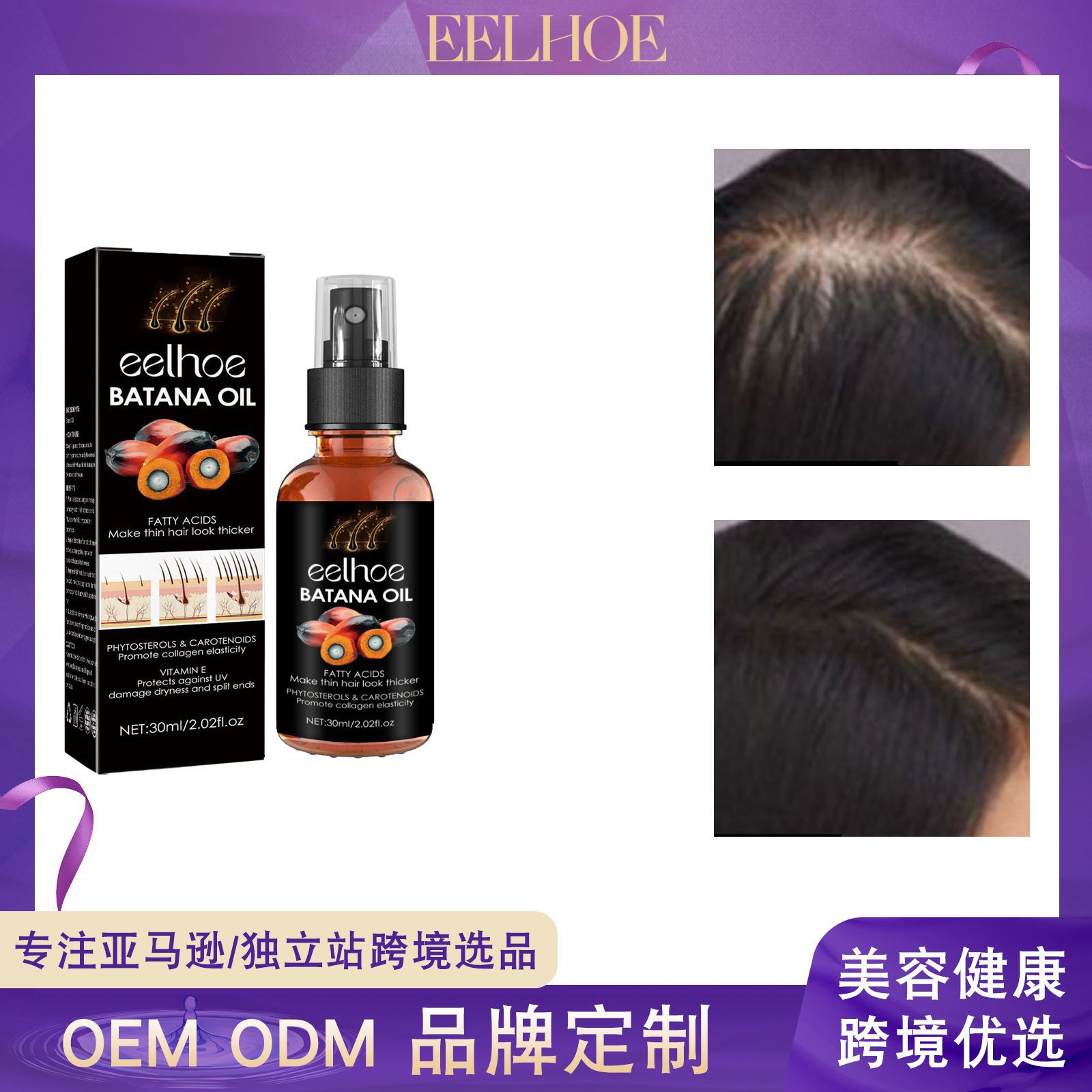 eelhoe巴塔纳密发喷雾深层滋润头皮修护发质强韧固发密发护发喷雾