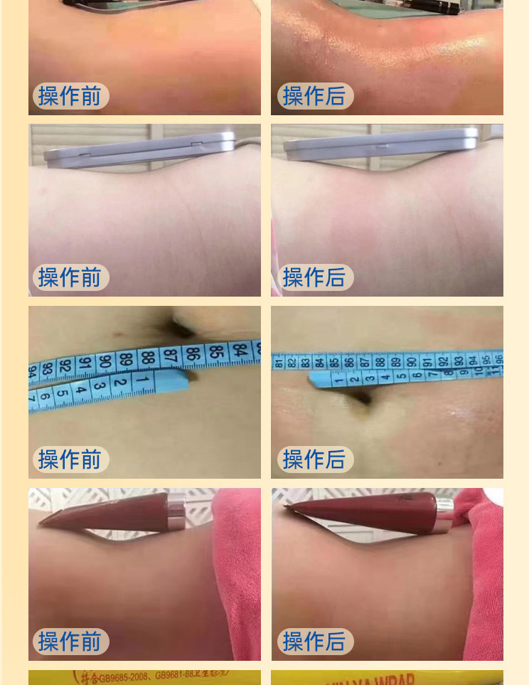 科以美厂家升级版隔空爆脂减肥仪产后塑型刮痧腹包排酸美容院器材