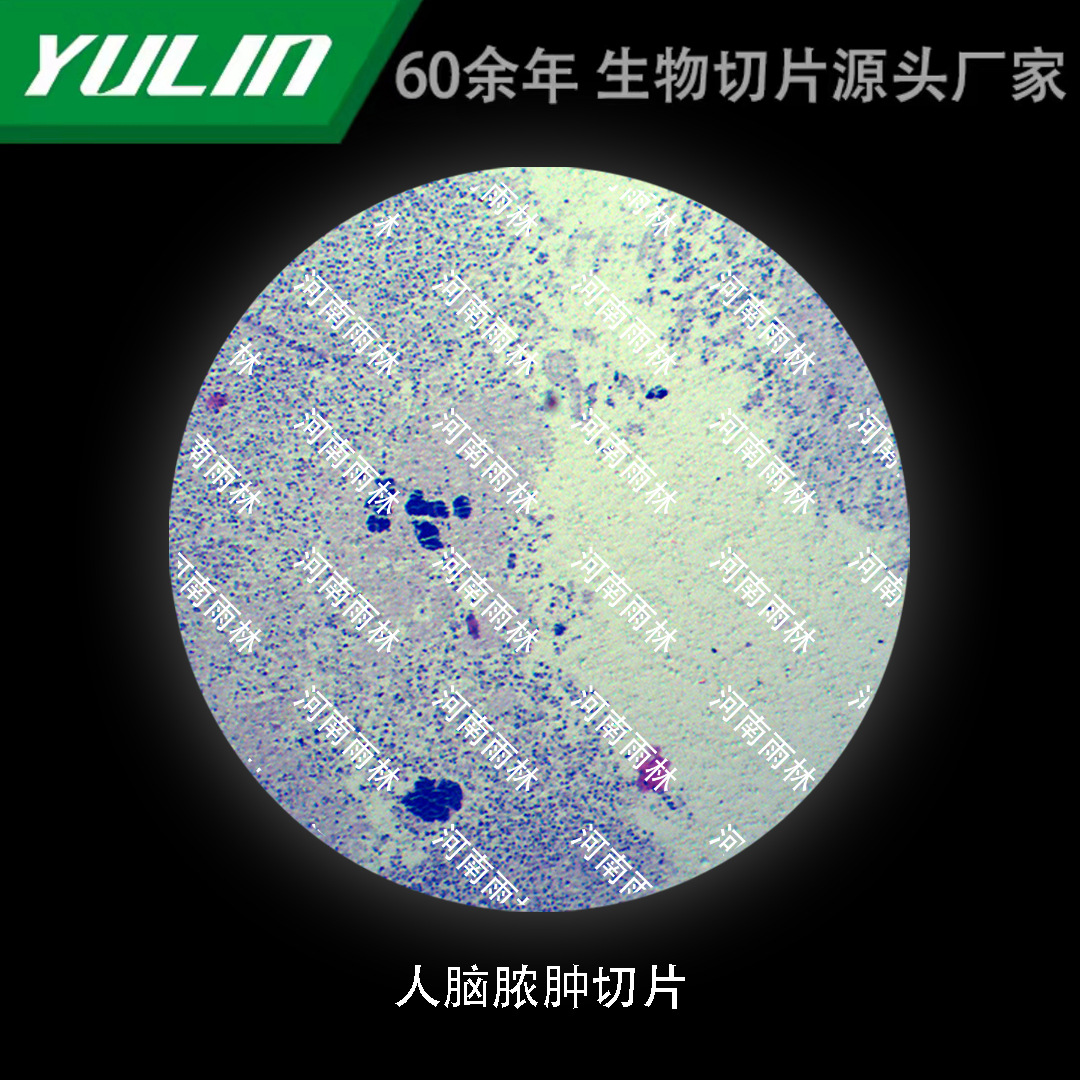 脑脓肿切片生物显微镜标本动物植物细胞载玻片观察实验高校评价订购