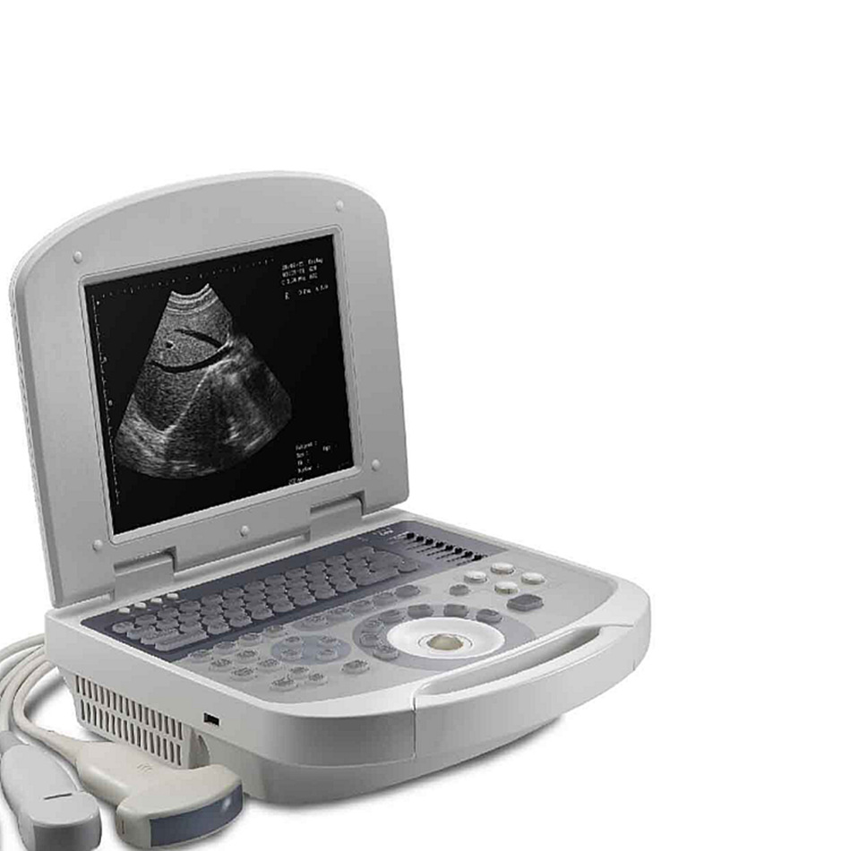 医用b超机价格,医用b超诊断仪便携式b超机,黑白超设备厂家直供