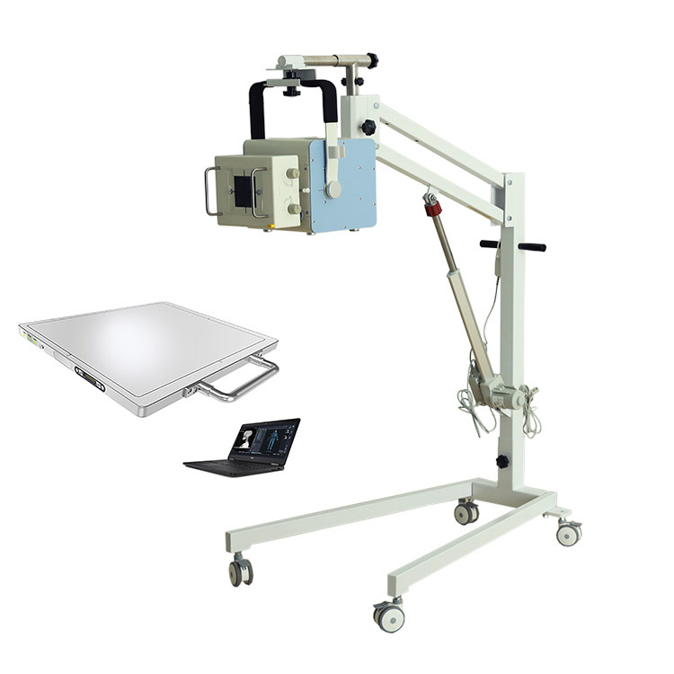 便携式x射线机 移动便携式dr机 小型便携式x光 便携式x光检测机