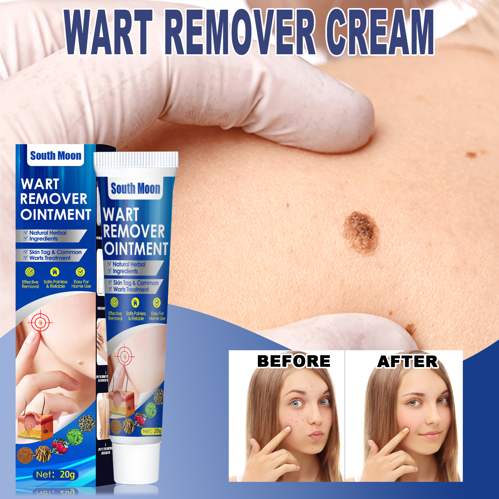 瘊疣平祛疣膏肉粒脖子丝状平抑瘊疣剂克疣膏手足脸部腋下