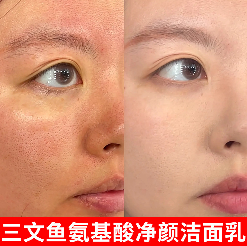 氨基酸洗面奶男女去黑头深层清洁收缩毛孔洁面温和控油祛痘洁面乳