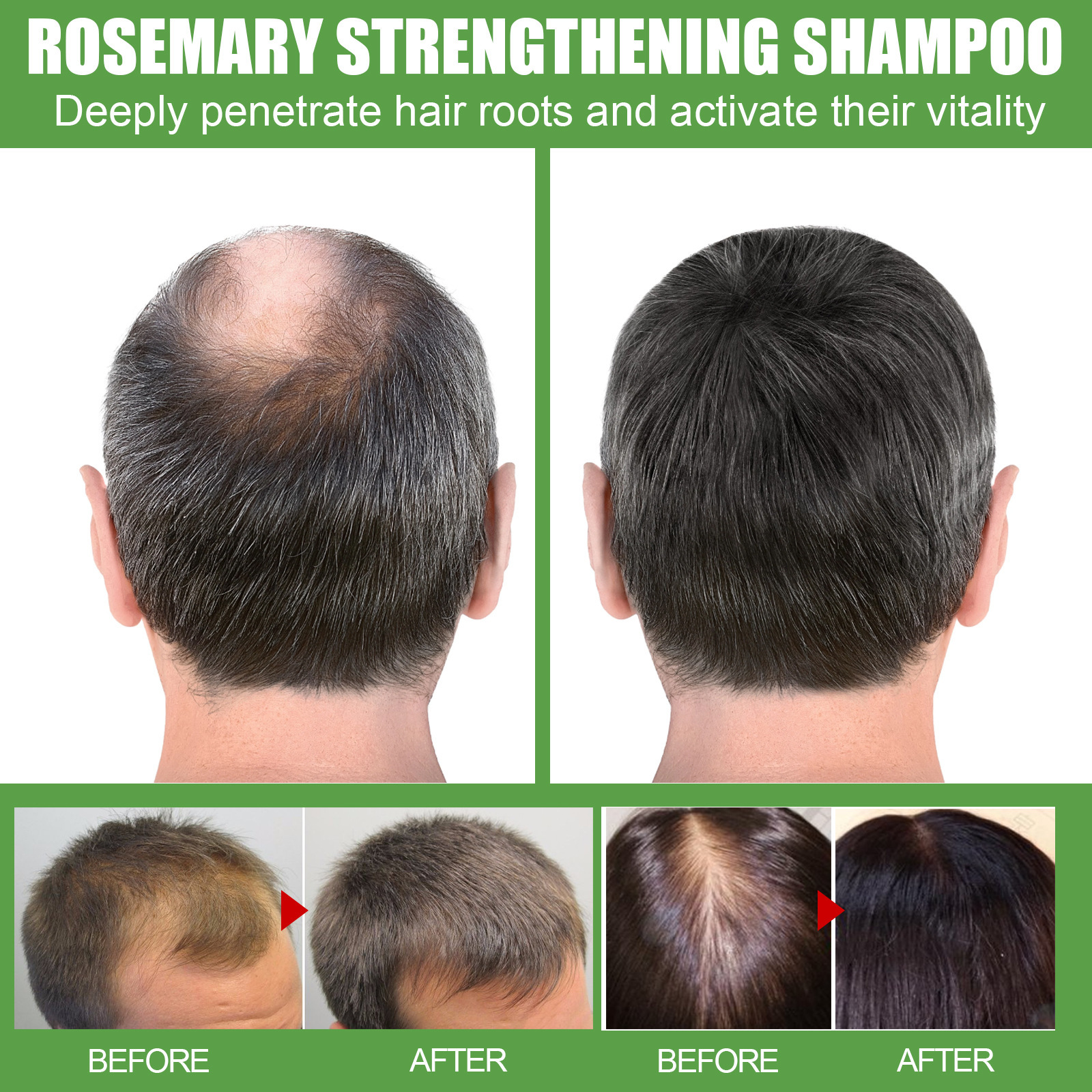 Eelhoe Rosemary Shampoo Deep Cleansing Massage Scalp Moisturizing Soft Thick Conditioning Shampoo