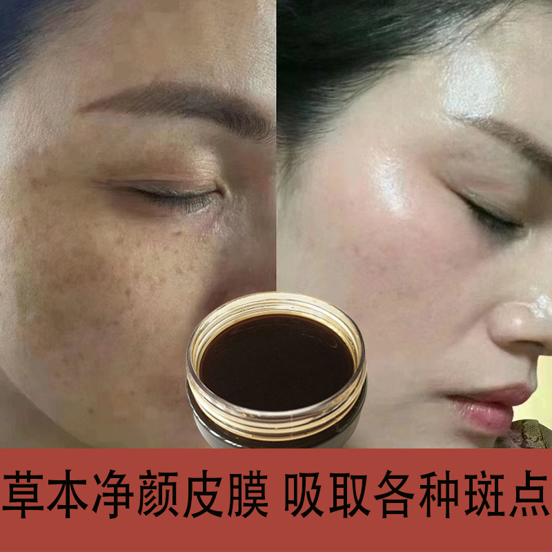 净颜术皮膜吸斑膜美容院美嫩白提亮肌肤淡暗黄黑色素草本撕拉面膜