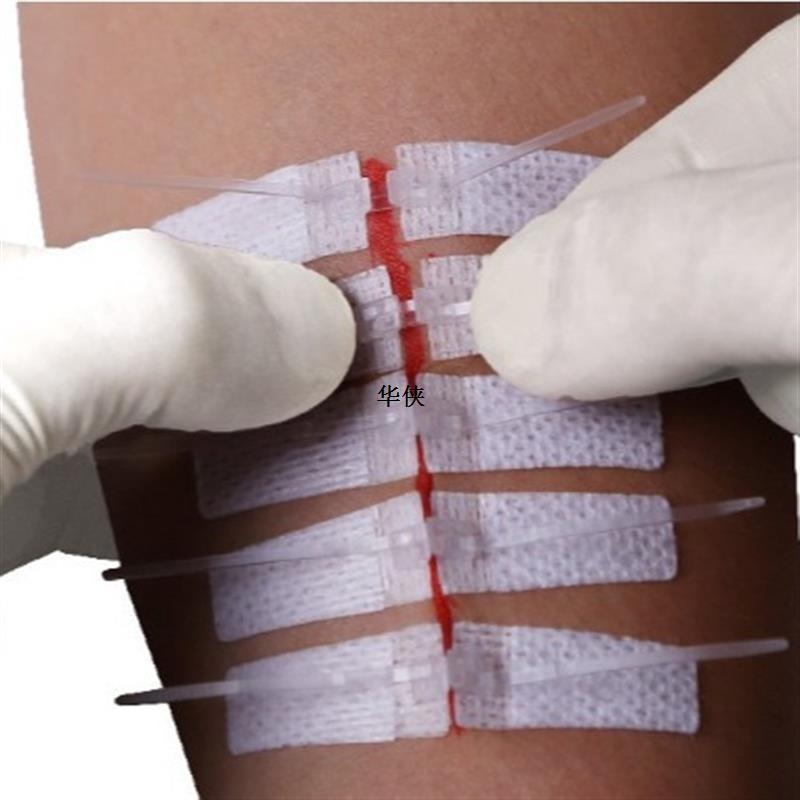 拉合式免缝胶带创增生抑制减张外贸出口疤痕剖腹产拉链胶布医用