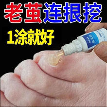 祛脚趾关节茧贴去脚老茧死皮软化剂手茧脚茧子去除神器去脚垫厚茧