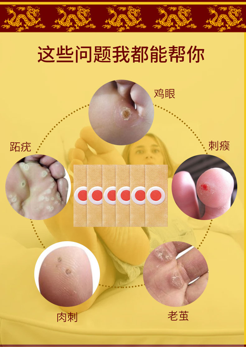 特一药业鸡眼贴净趾日常尤根鸡疣灵膏药肉刺瘊子贴一件代发