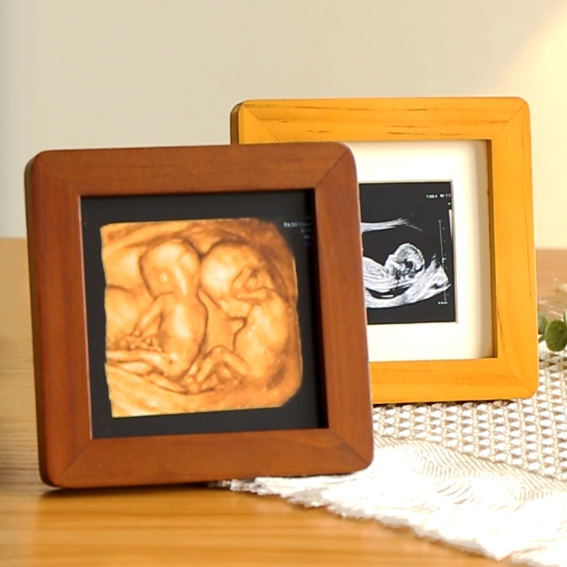 63n宝宝洗照片打印加相框小摆台diy定 制四维彩超儿童正方形周岁