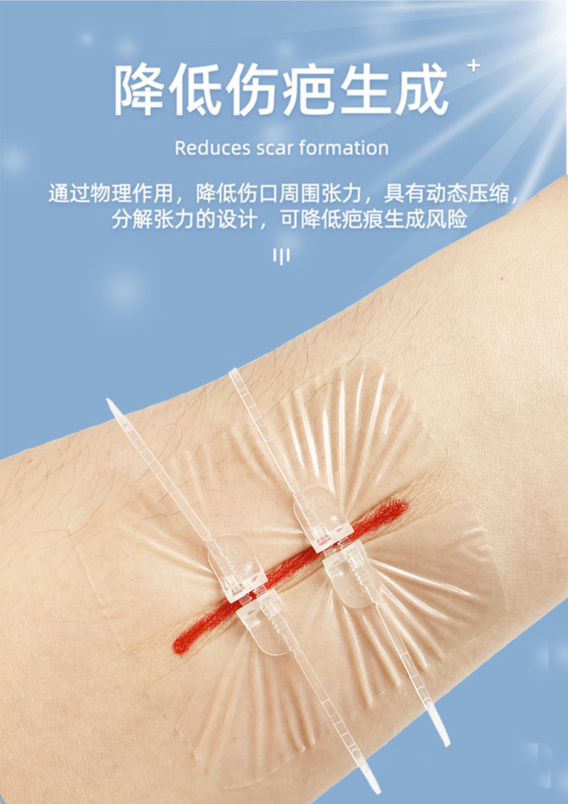 医用皮肤伤口缝合器减张器疤痕免缝合剖腹产胶带拉链式创口贴2扣
