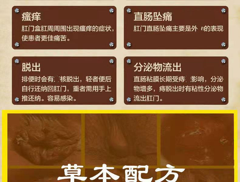 云南本草肛痔舒喷剂草本精华痔疮喷剂消肉球屁舒膏肛门瘙痒痔疮药