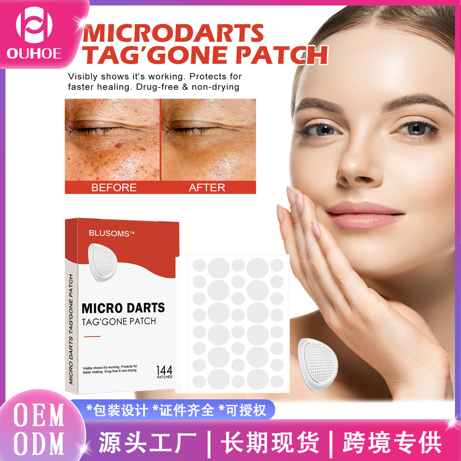 Ouhoe Acne Patch Skin Acne Acne Acne Black Mole Skin Label Wart Corns Spot Patch