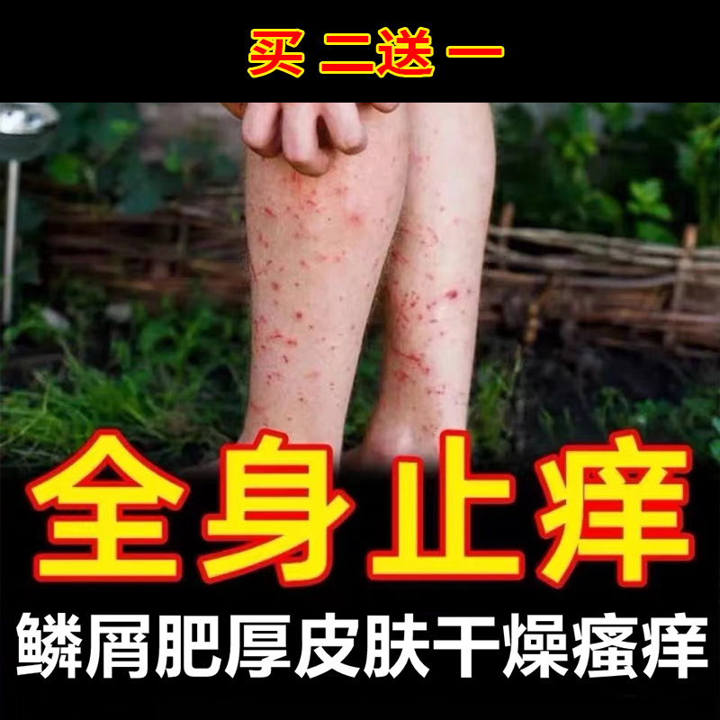 舒肤止痒膏正品芙舒美草本抑菌膏皮肤断痒膏百草妙方益舒膏阴痒膏