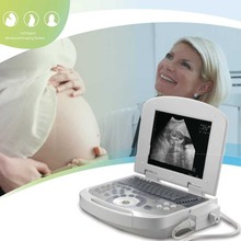 外贸出口ultrasound scan便携式B超批发产科B型黑白超声诊断仪