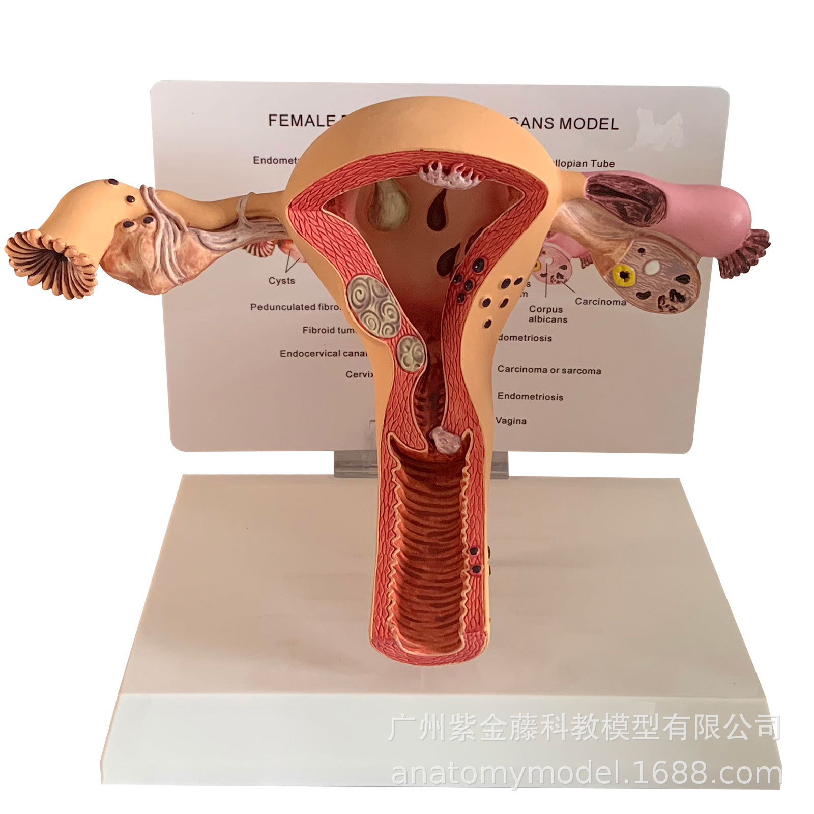 女性生殖系统病理模型 子宫卵巢阴道结构教学仿真模型医用