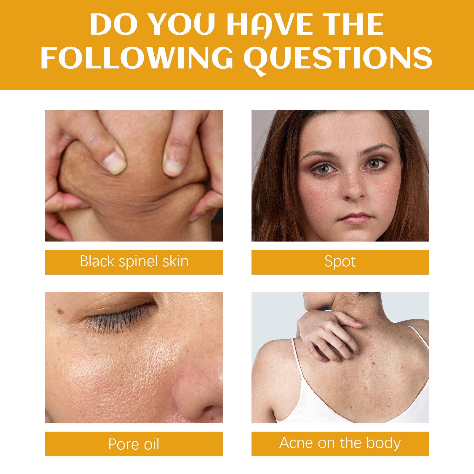 Eelhoe Spot Cleansing Facial Cleanser Deep Cleansing Facial Body Skin Fading Spot Whitening Brightening Skin