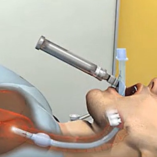 可视气管插管摄像头模组整体方案,可视插管光棒,可视喉罩,-阿里巴巴