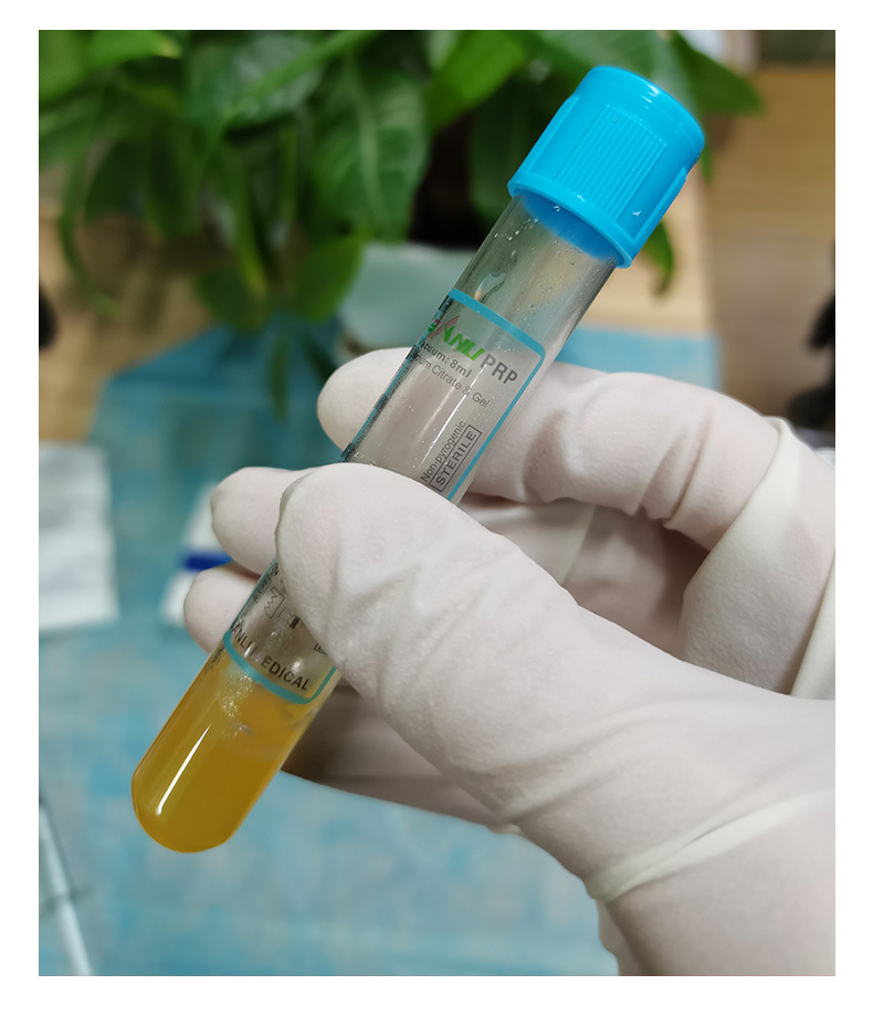 三力医用prp采血管血清分离管 prp提取试管美容管8ml抗凝剂分离胶