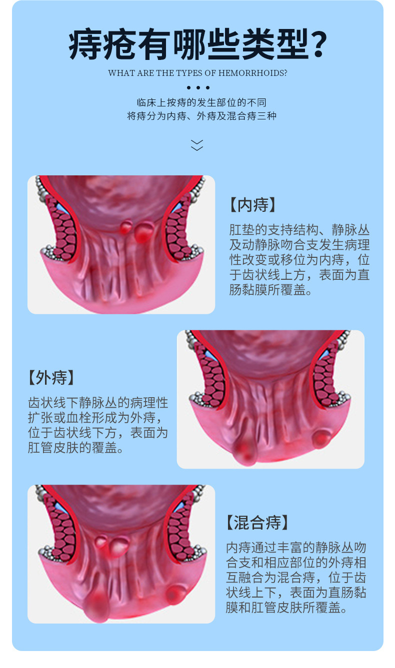 仁和康宝药房同款男女内外混合庤凝胶肛门去肉球草本乳膏痔疮膏