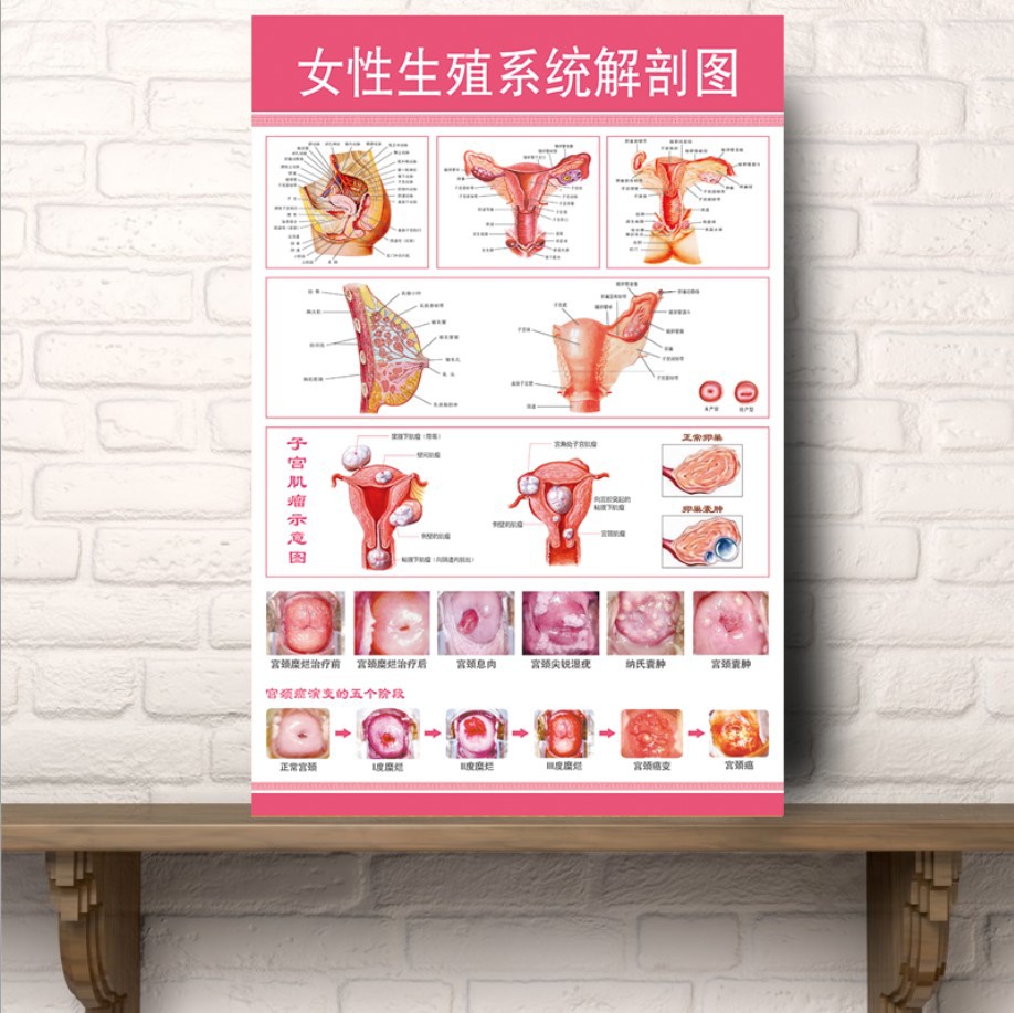 女性泌尿系统图男女泌尿生殖器解剖图医学人体生殖系统解剖挂图贴