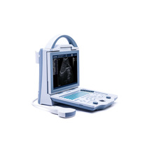便携式全数字超声诊断系统B超机便携式黑白超标配腹部探头带三证