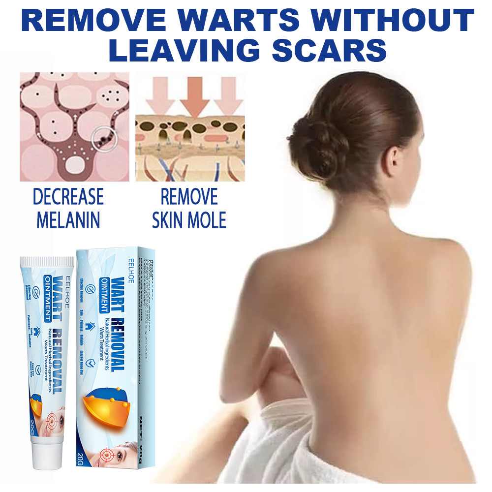 Eelhoe Wart Cream Cleansing Skin Repair Care Body Face Removal Facial Label Keyou Cream