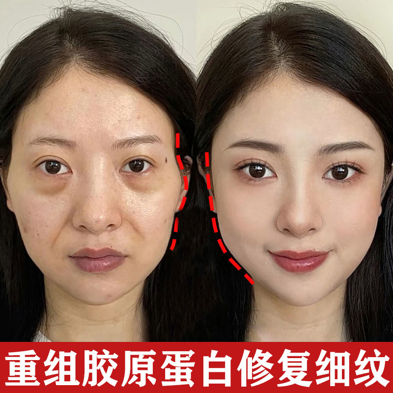 胶原蛋白填充重组霜逆龄紧致霜抚平细纹去皱润肤补水保湿抗皱面霜