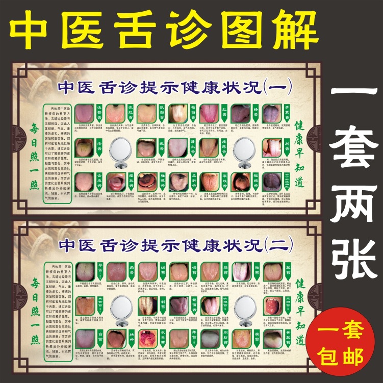 厂家直销中医舌诊完全图解图谱美容院海报挂图养生图片宣传墙画装