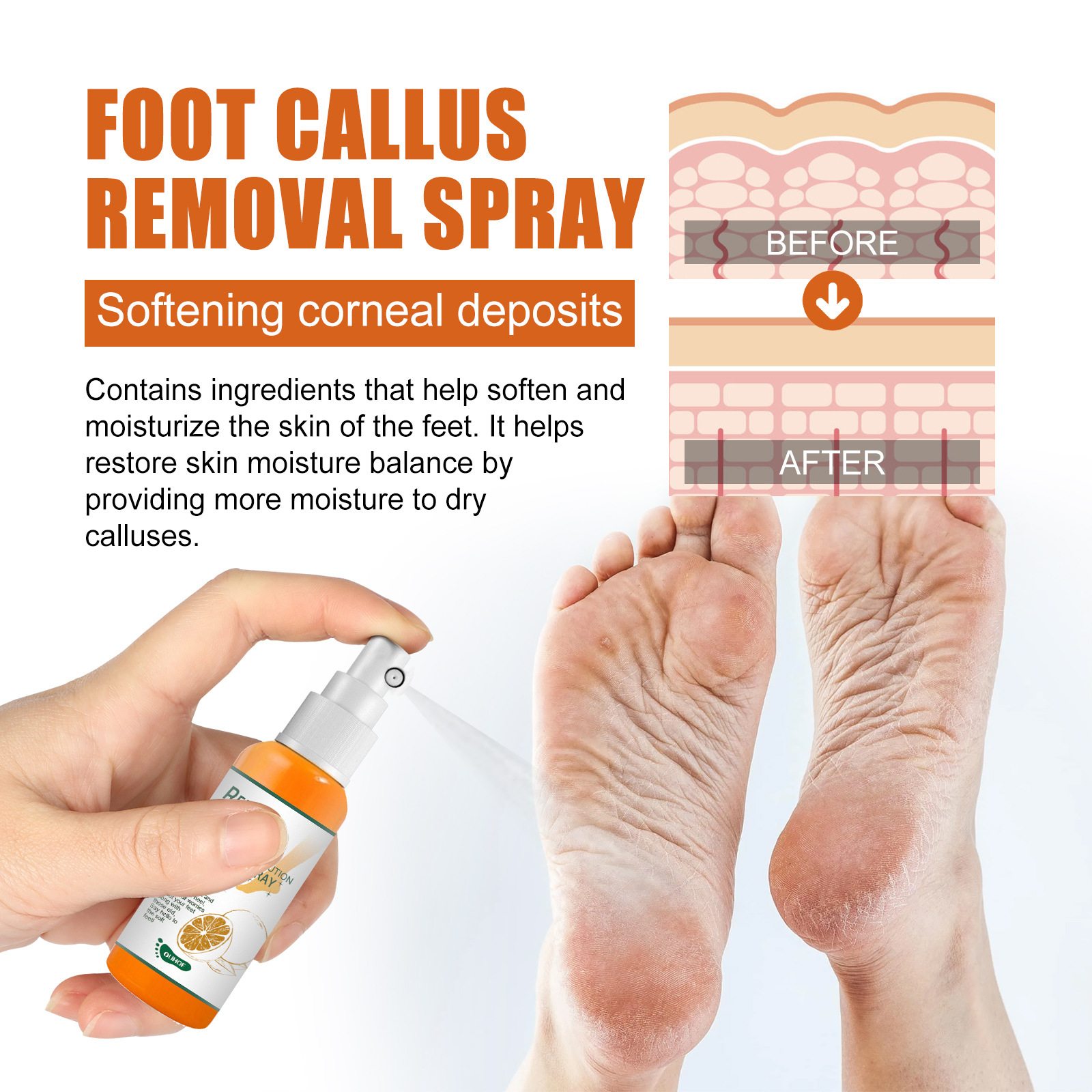 Ouhoe Foot Exfoliating Spray Repair Foot Heel Calluses Dead Skin Anti-Chapping Foot Care Spray