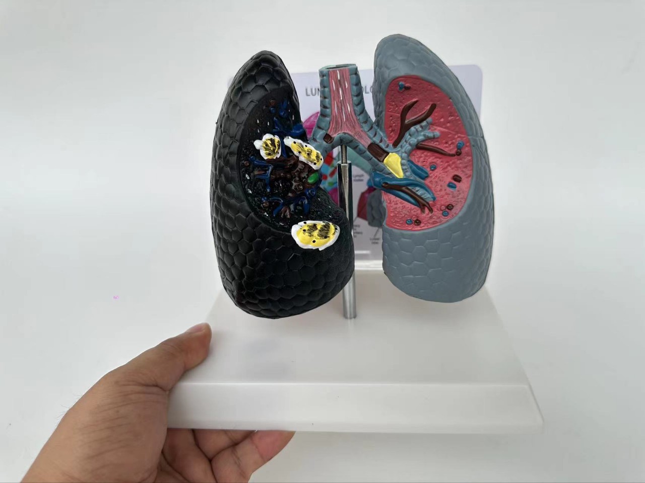 解剖吸烟肺健康肺模型呼吸肺与支气管教具人体内脏呼吸理对比演示