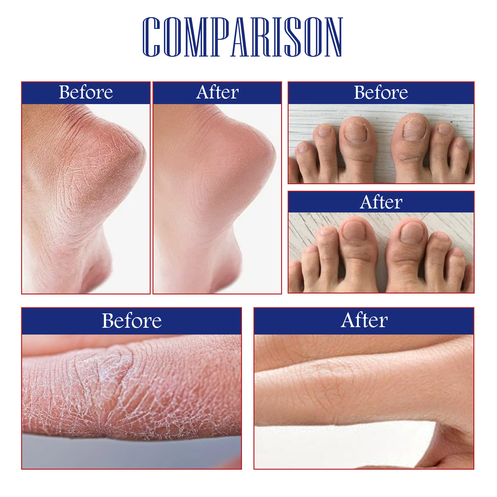 South Moon Hand and Foot Repair Cream Skin Repair Anti-Freezing Dry Crack Peeling Rough Skin Cream