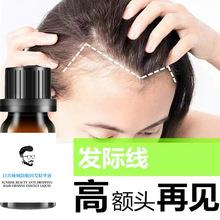 发际线精华液头发护理液防脱固发液护发精油养发头皮发根精华液