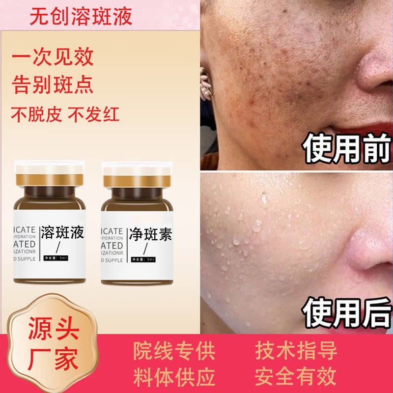 微晶无创溶斑液黄褐斑祛斑液雀斑提取液不发红不蜕皮祛斑精华液