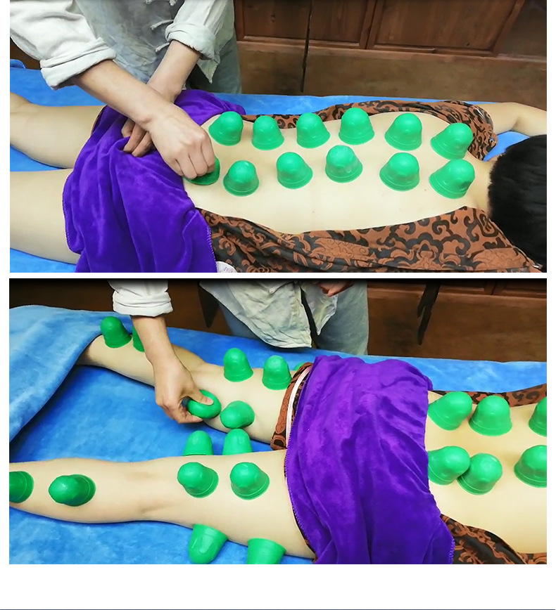 分钟享瘦硅胶拔罐针灸发热磁石灸罐隐形针灸康复芯片美容院热疗