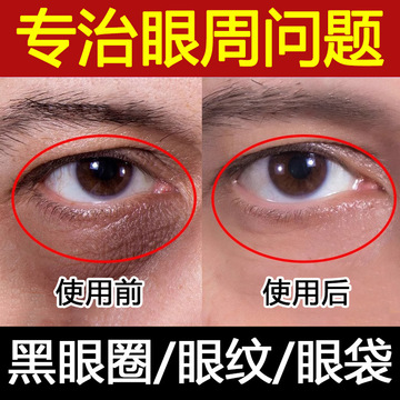 眼霜去皱紧致祛正品眼袋黑眼圈改善细纹脂肪粒抗皱超声刀眼霜