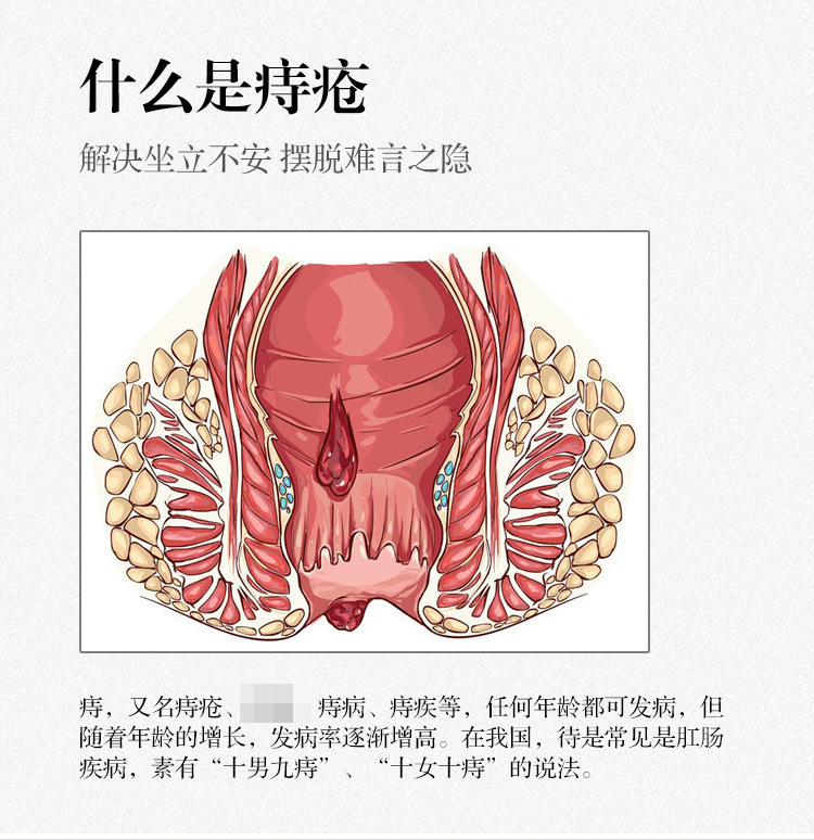 普瑞尔厂家制作云南本草痔疮膏草本精华抑菌断痔膏挖根消痔疮