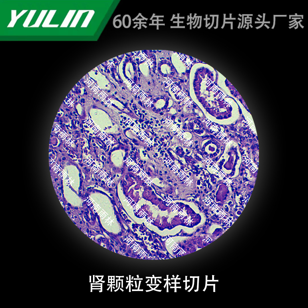 肾颗粒变样生物显微镜标本动物植物细胞载玻片观察实验高校