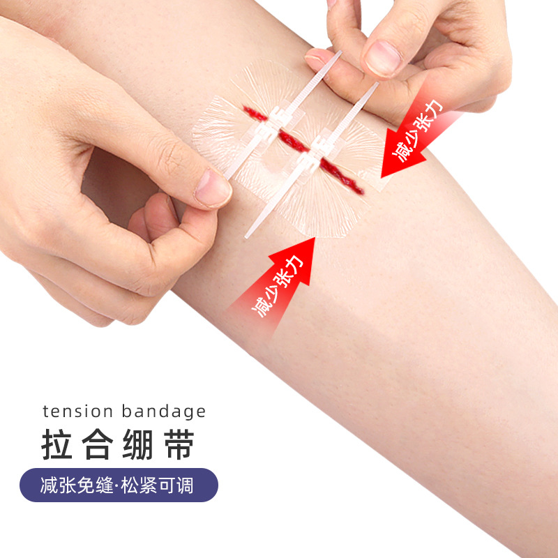弹性绑带创口贴pu透明拉链式皮肤免缝合锁扣拉合自粘绷带贴片