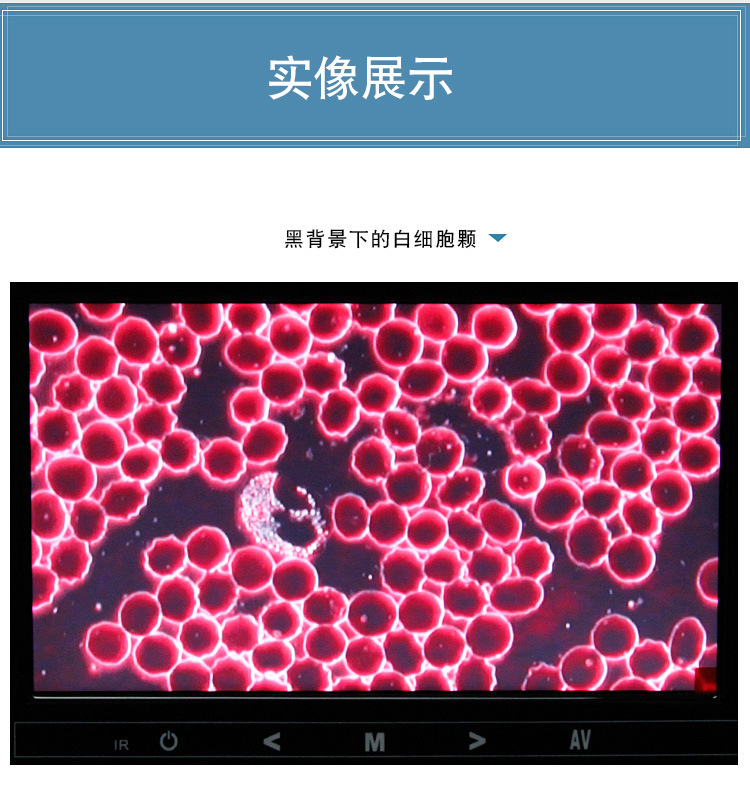西派克黑背景一滴血检测仪黑背景 益生菌酵素菌专用生物显微镜