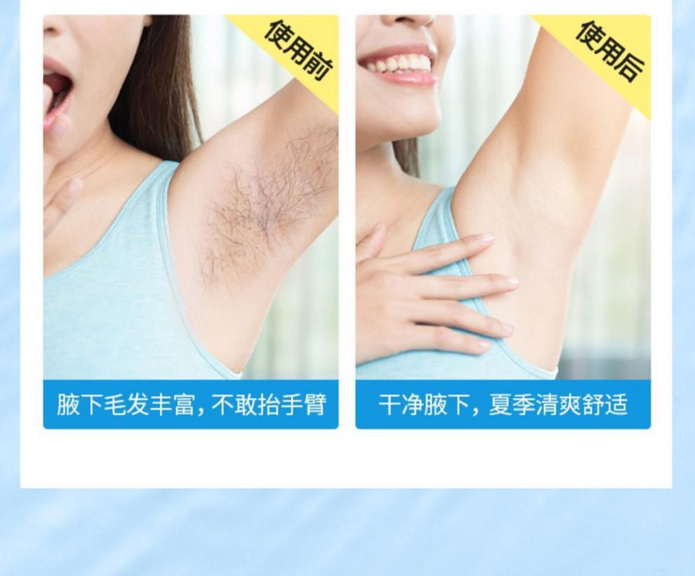 脱毛器保密发货女士刮毛手动除毛腋毛腿毛私处剃毛去毛脱毛器