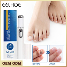 EELHOE 指甲蓝光激光笔 灰指甲修护激光笔简单易用去异味指甲护理